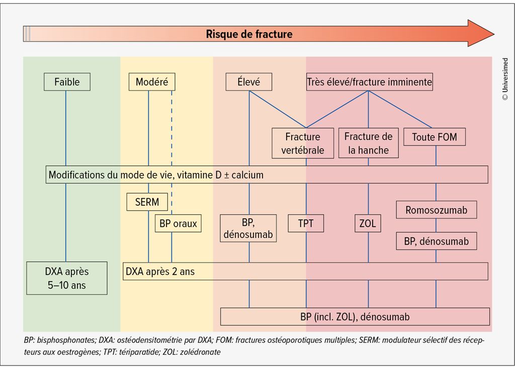 Ostéoporose Vue d’ensemble du diagnostic et du traitement Médecine — free download